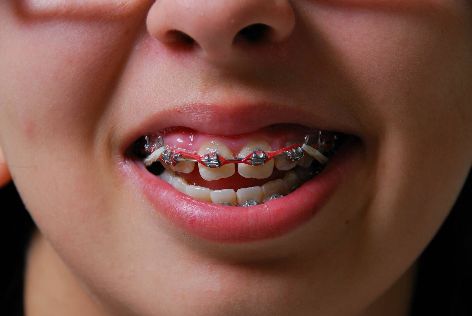 Henderson Family Dentistry